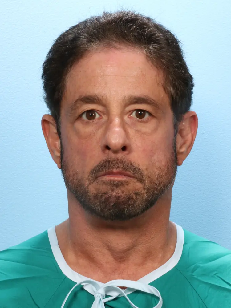 Male Facial Surgery - Case 1819 - Before