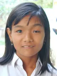 Volunteer Reconstructive Surgery - Case 276 - Before