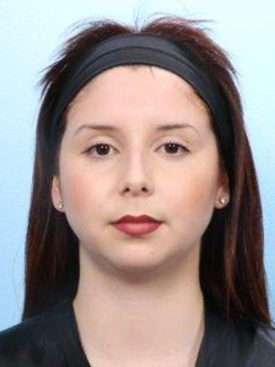 Chin Implant Patient Photo - Case 1769 - before view-1