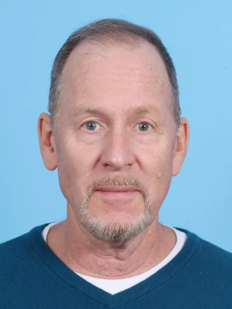 Male Facial Surgery - Case 16893 - Before