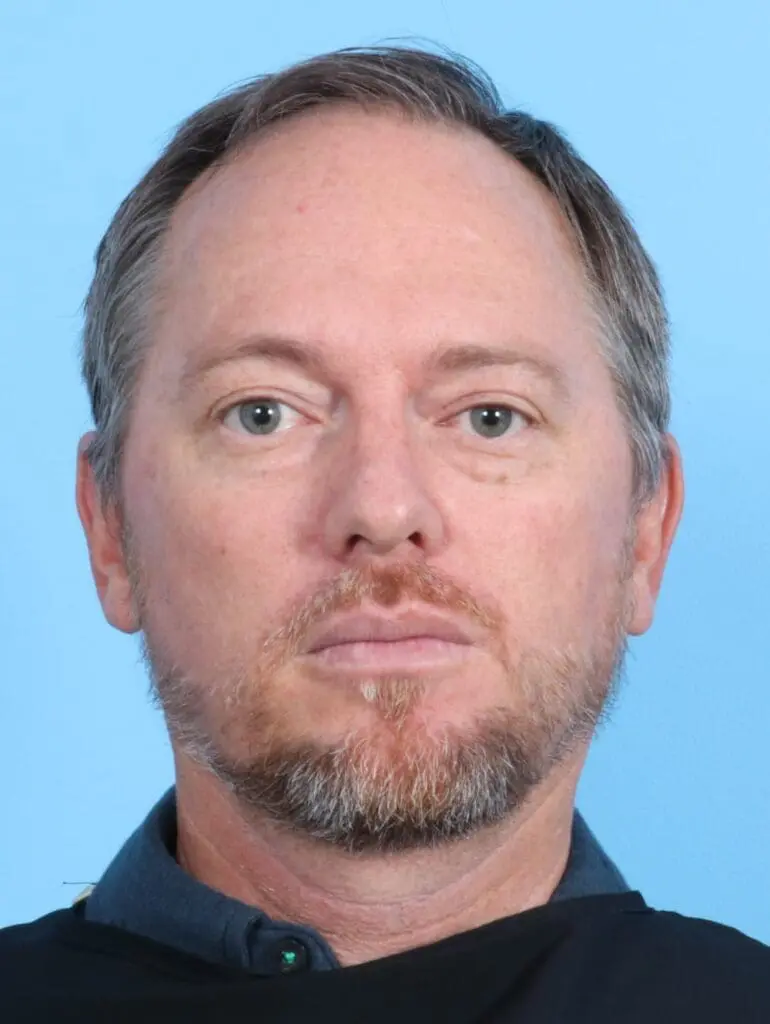 Male Facial Surgery - Case 21493 - Before