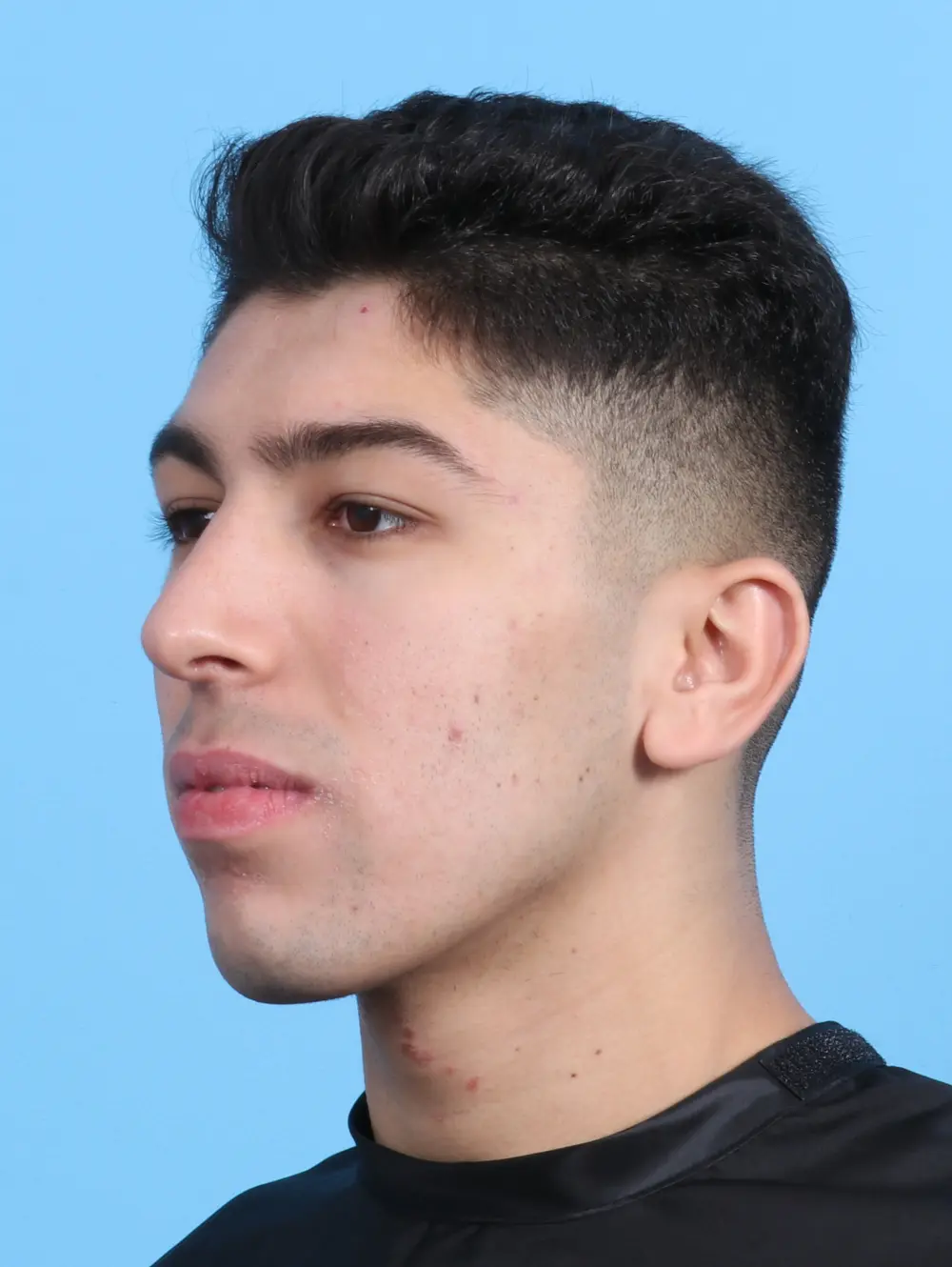 Male Facial Surgery Patient Photo - Case 21884 - after view-2