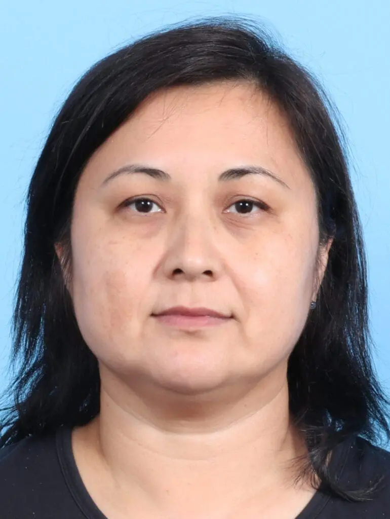 Eyelid Surgery - Case 24470 - Before