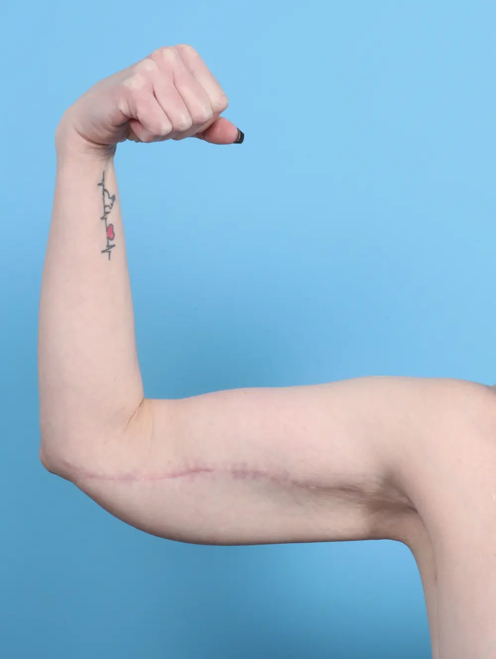 After Weight Loss Patient Photo - Case 25346 - after view-1