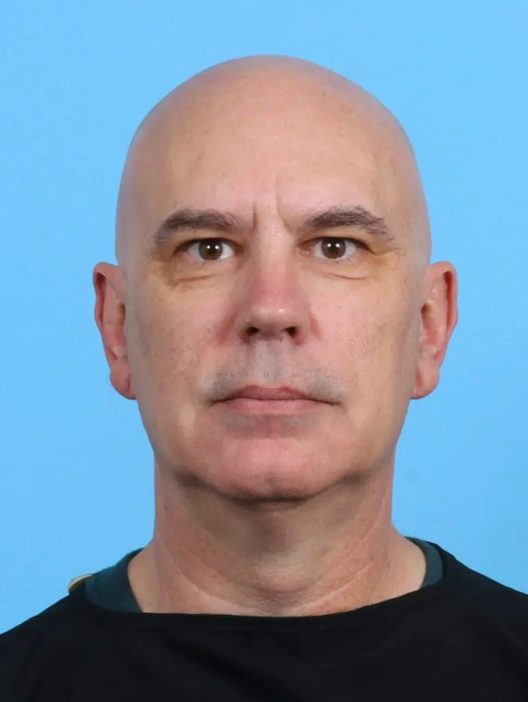 Eyelid Surgery - Case 27777 - Before