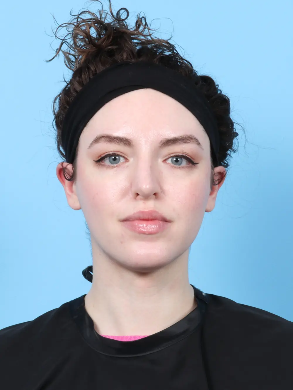 Rhinoplasty Patient Photo - Case 27689 - after view-2