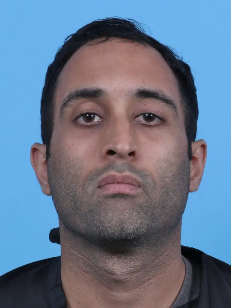 Eyelid Surgery - Case 27965 - After