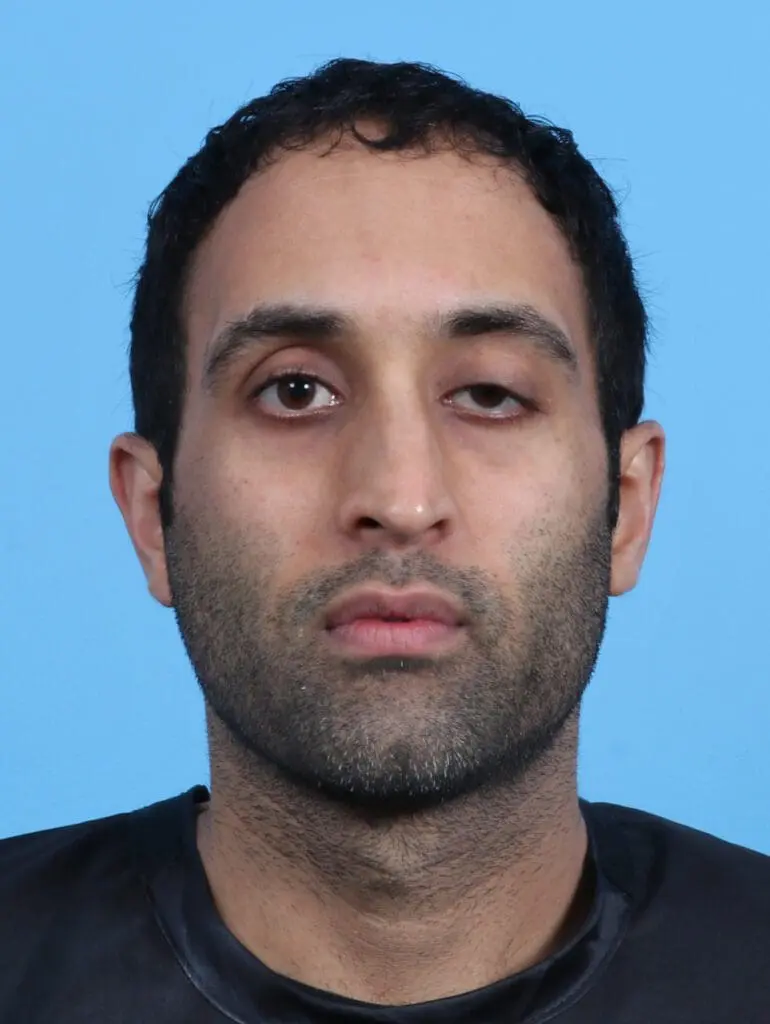 Eyelid Surgery - Case 27965 - Before