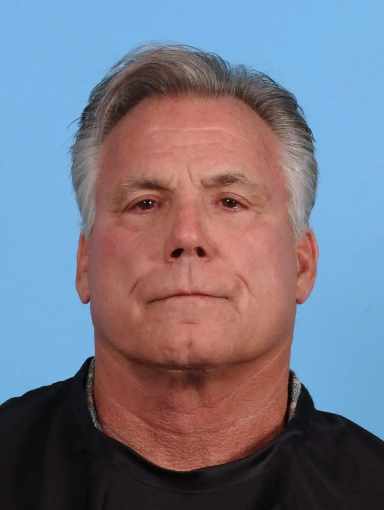 Eyelid Surgery - Case 28105 - After