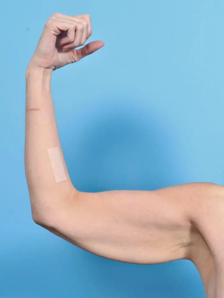 Arm Lift - Case 29258 - Before