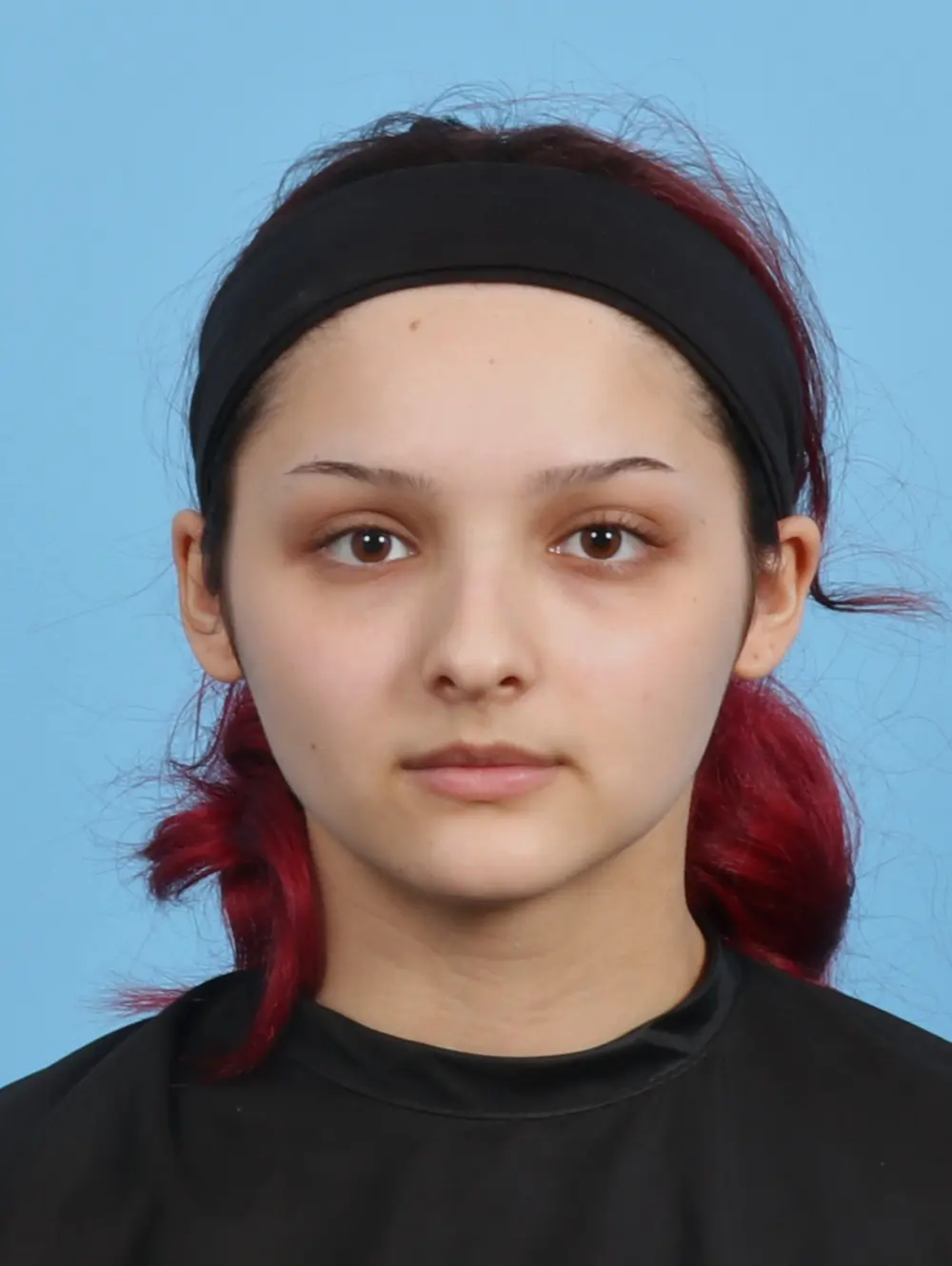 Rhinoplasty Patient Photo - Case 29761 - before view-2