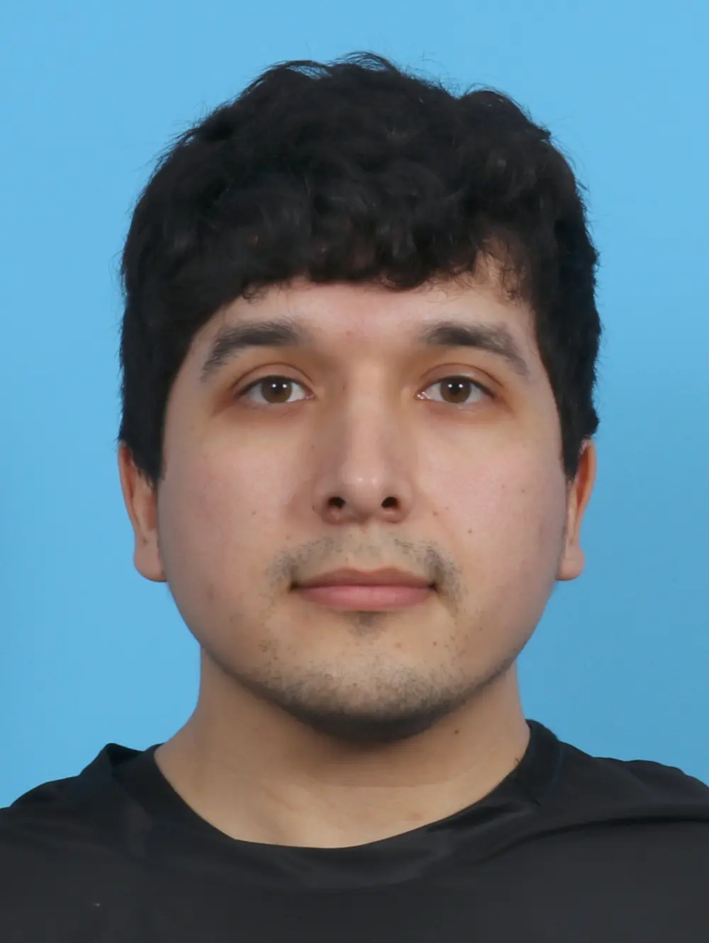 Rhinoplasty Patient Photo - Case 29985 - after view-2