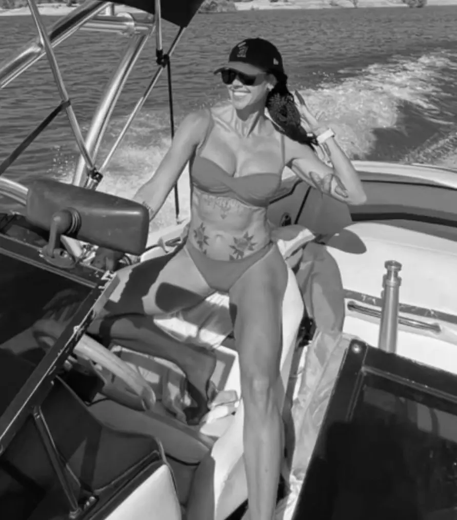 Breast Implant Revision Patient Breast Implant Revision Patient