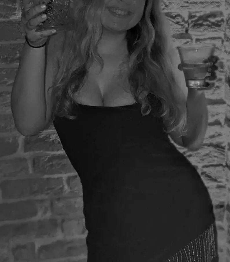 Breast Reduction Patient Breast Reduction Patient