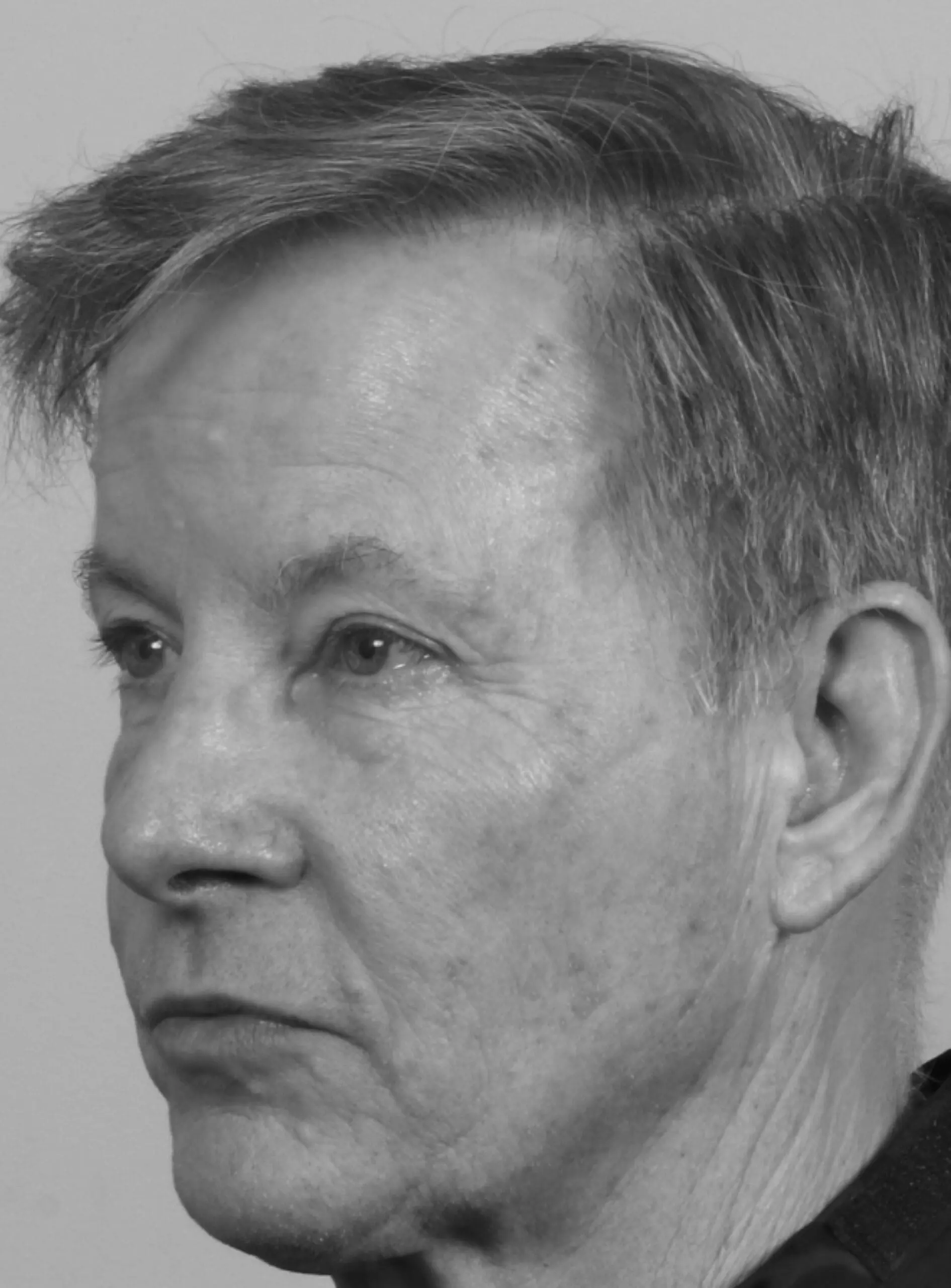 After Eyelid Surgery