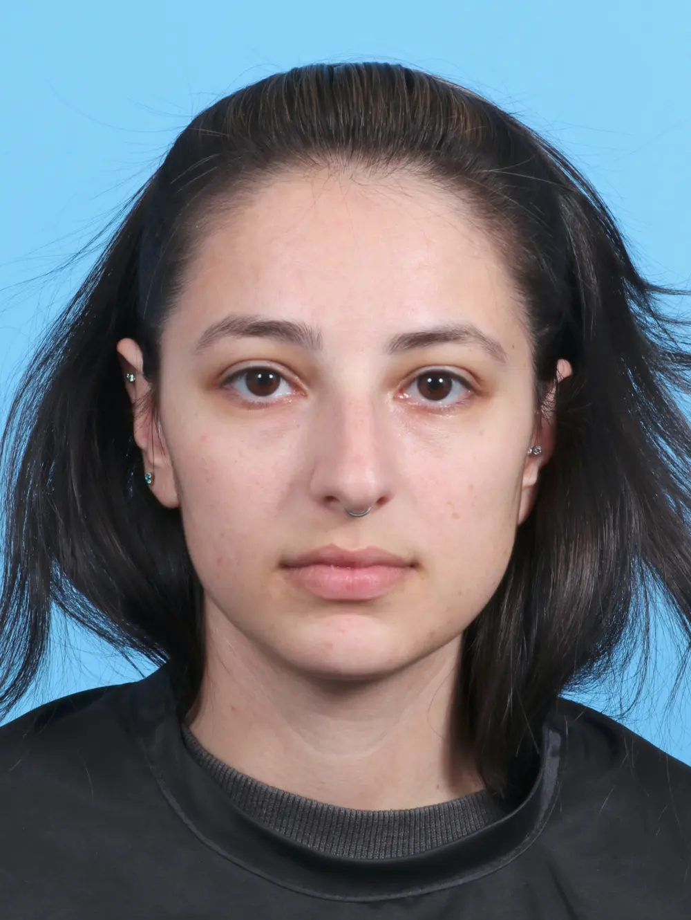 Rhinoplasty Patient Photo - Case 45220 - before view-2