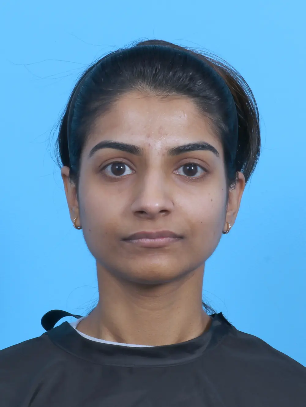 Rhinoplasty Patient Photo - Case 45303 - before view-2