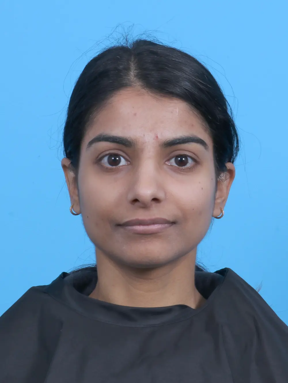 Rhinoplasty Patient Photo - Case 45303 - after view-2