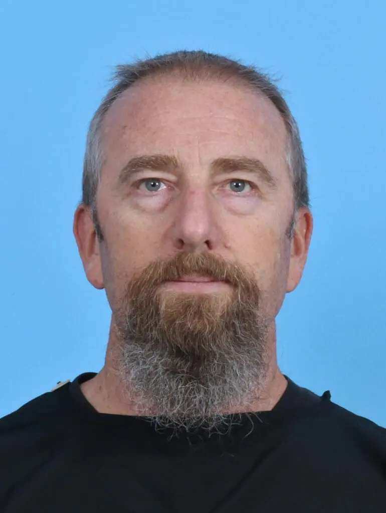 Eyelid Surgery - Case 46593 - Before