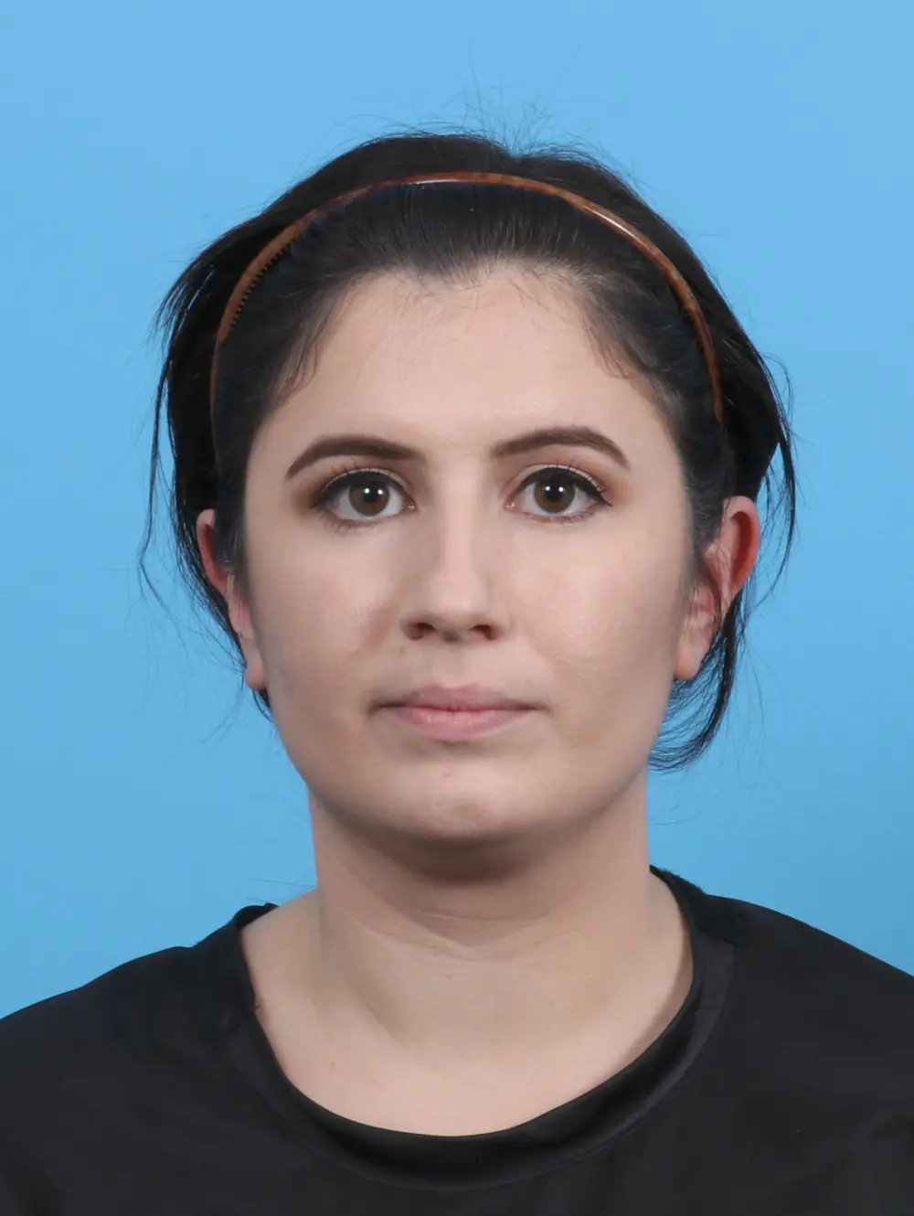 Chin Implant Patient Photo - Case 46695 - before view-2