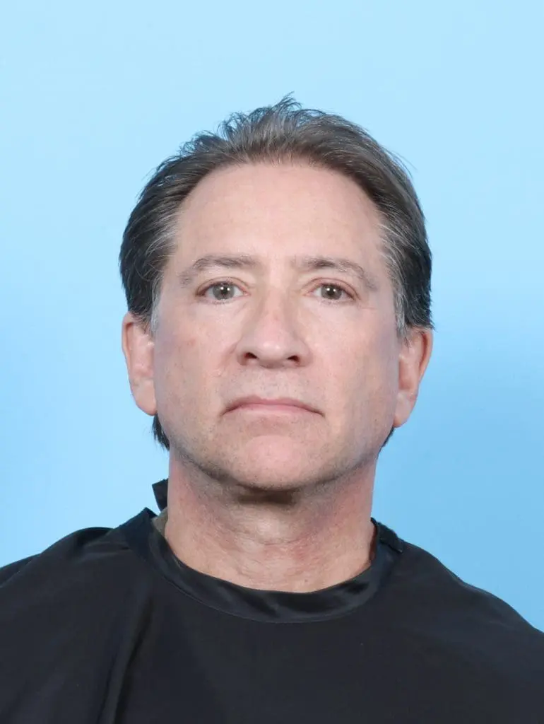 Facelift / Neck Lift - Case 47562 - After