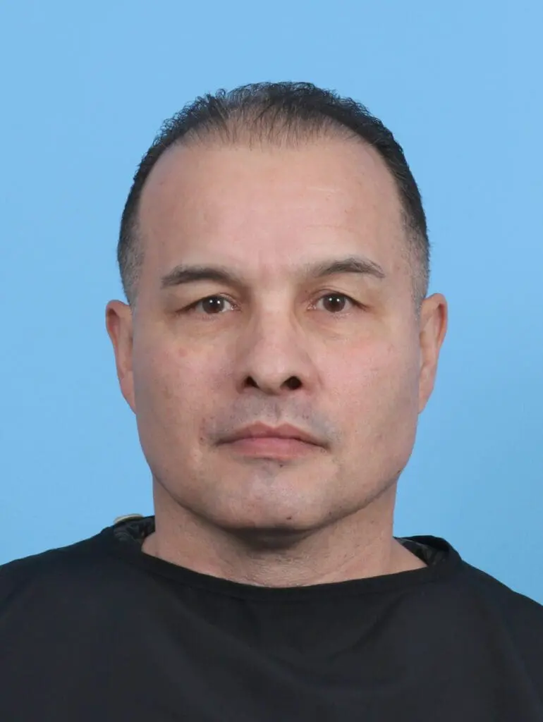 Eyelid Surgery - Case 47644 - Before