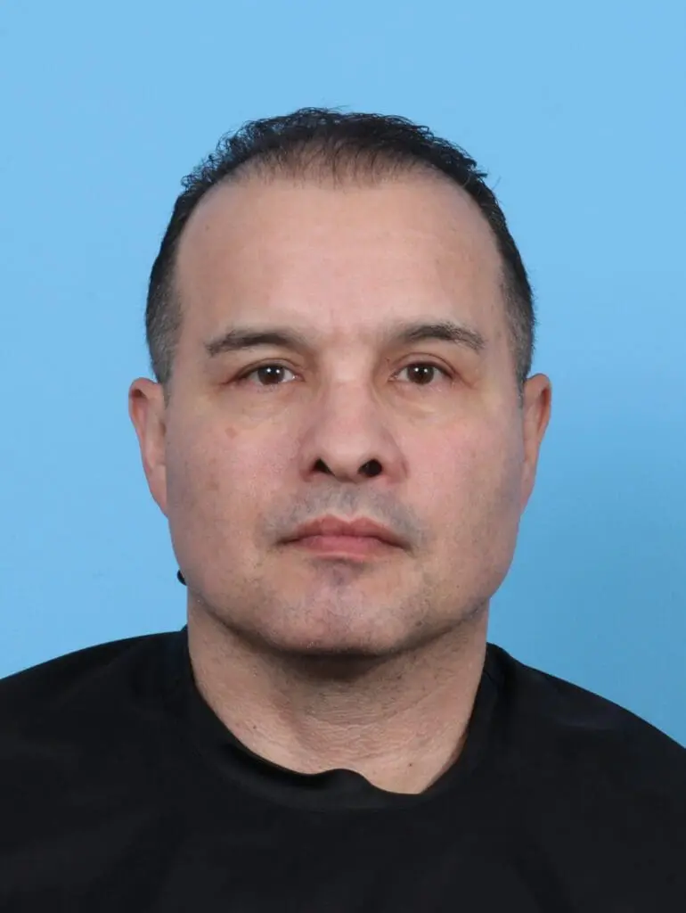 Eyelid Surgery - Case 47644 - After