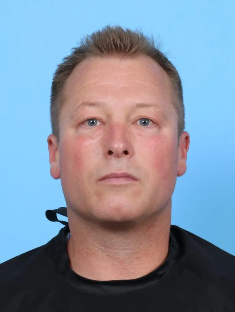 Eyelid Surgery - Case 50892 - After