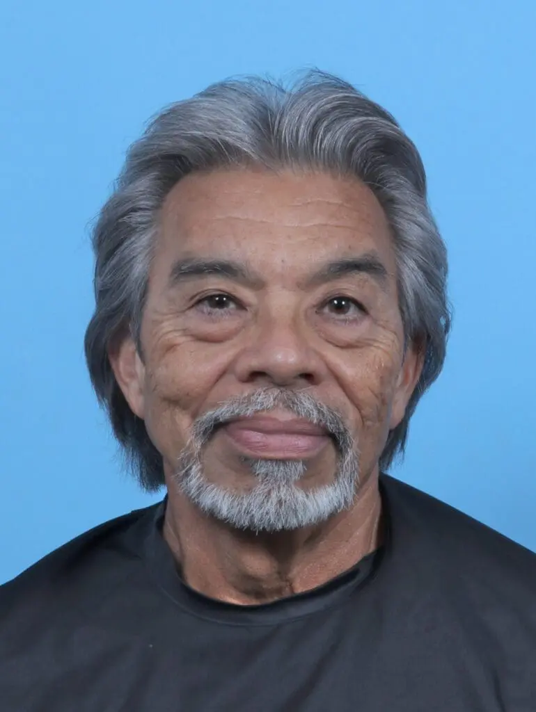 Eyelid Surgery - Case 50908 - Before