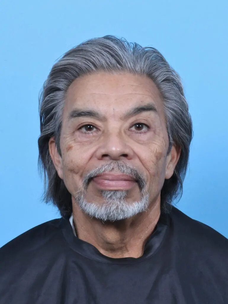 Eyelid Surgery - Case 50908 - After