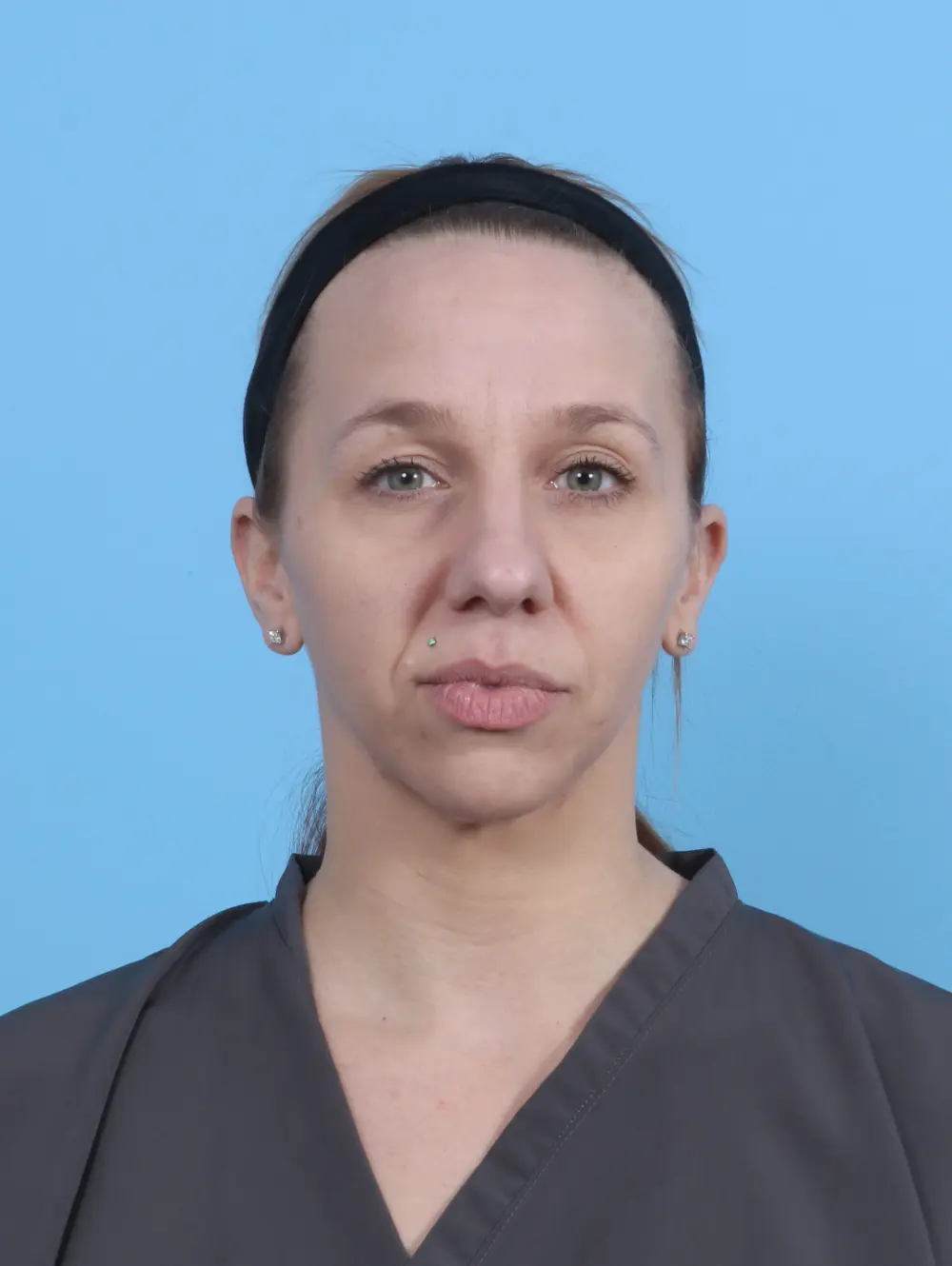 Rhinoplasty Patient Photo - Case 52161 - before view-2