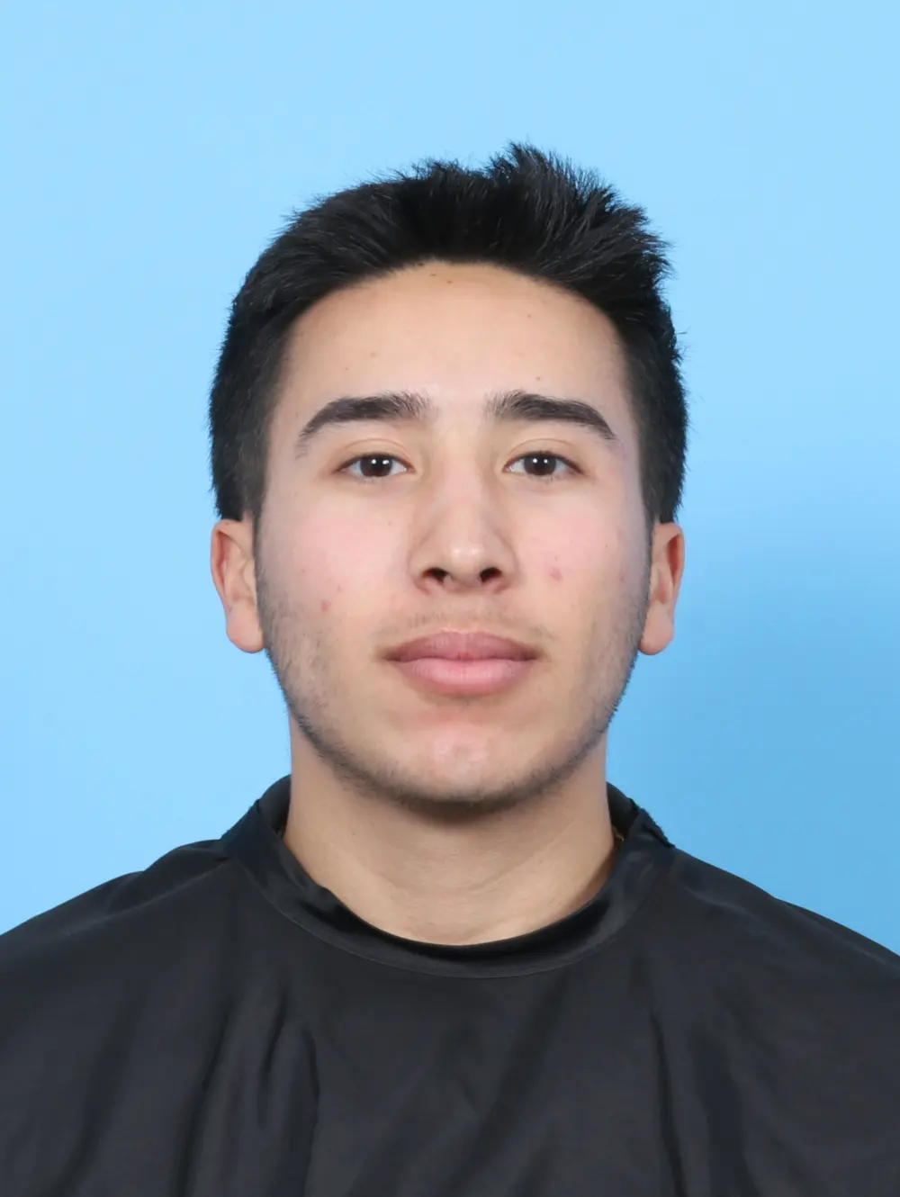 Male Facial Surgery Patient Photo - Case 52501 - after view-2