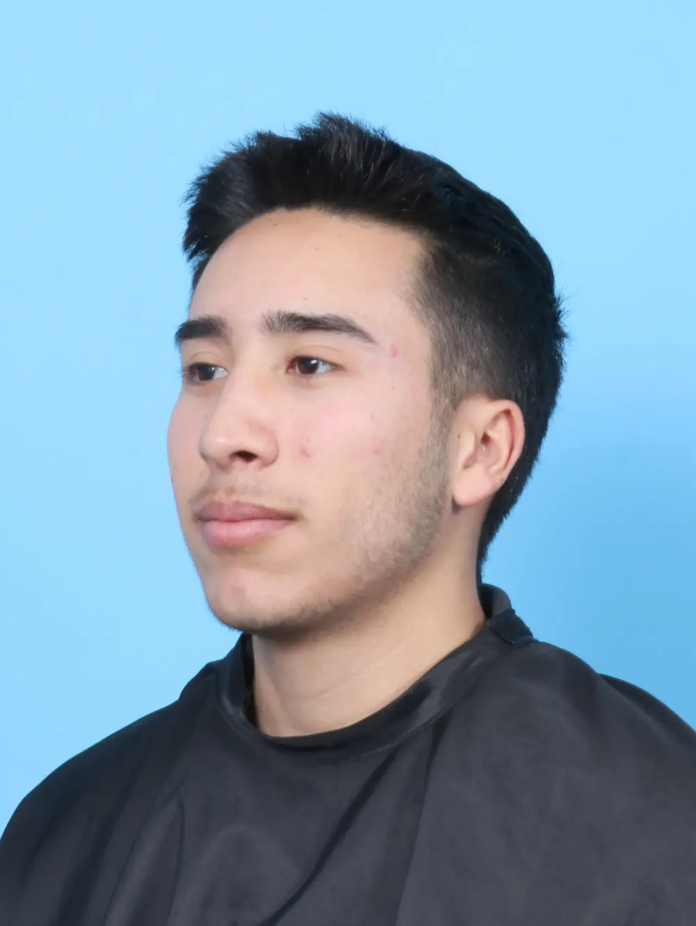 Male Facial Surgery Patient Photo - Case 52501 - after view-1