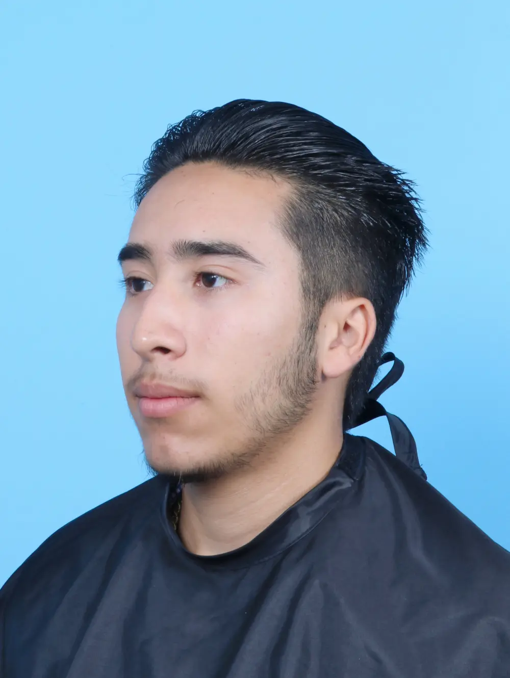 Male Facial Surgery Patient Photo - Case 52501 - before view-1