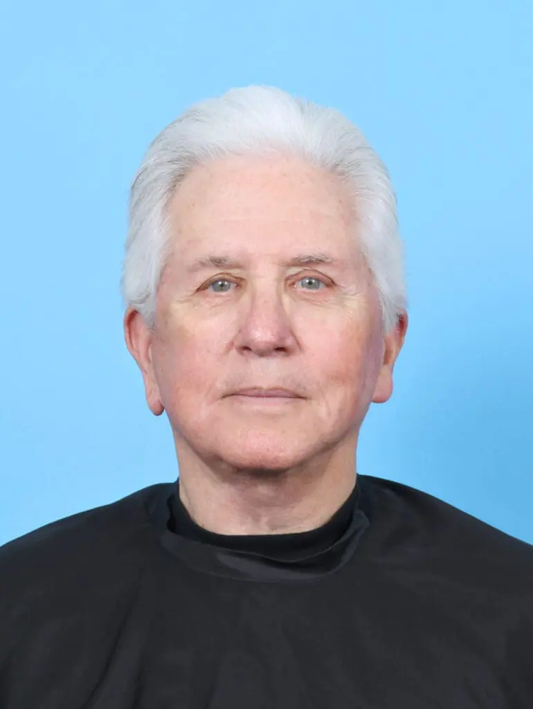 Facelift / Neck Lift - Case 52918 - After