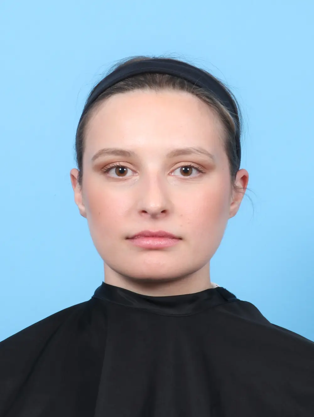 Rhinoplasty Patient Photo - Case 54542 - before view-2