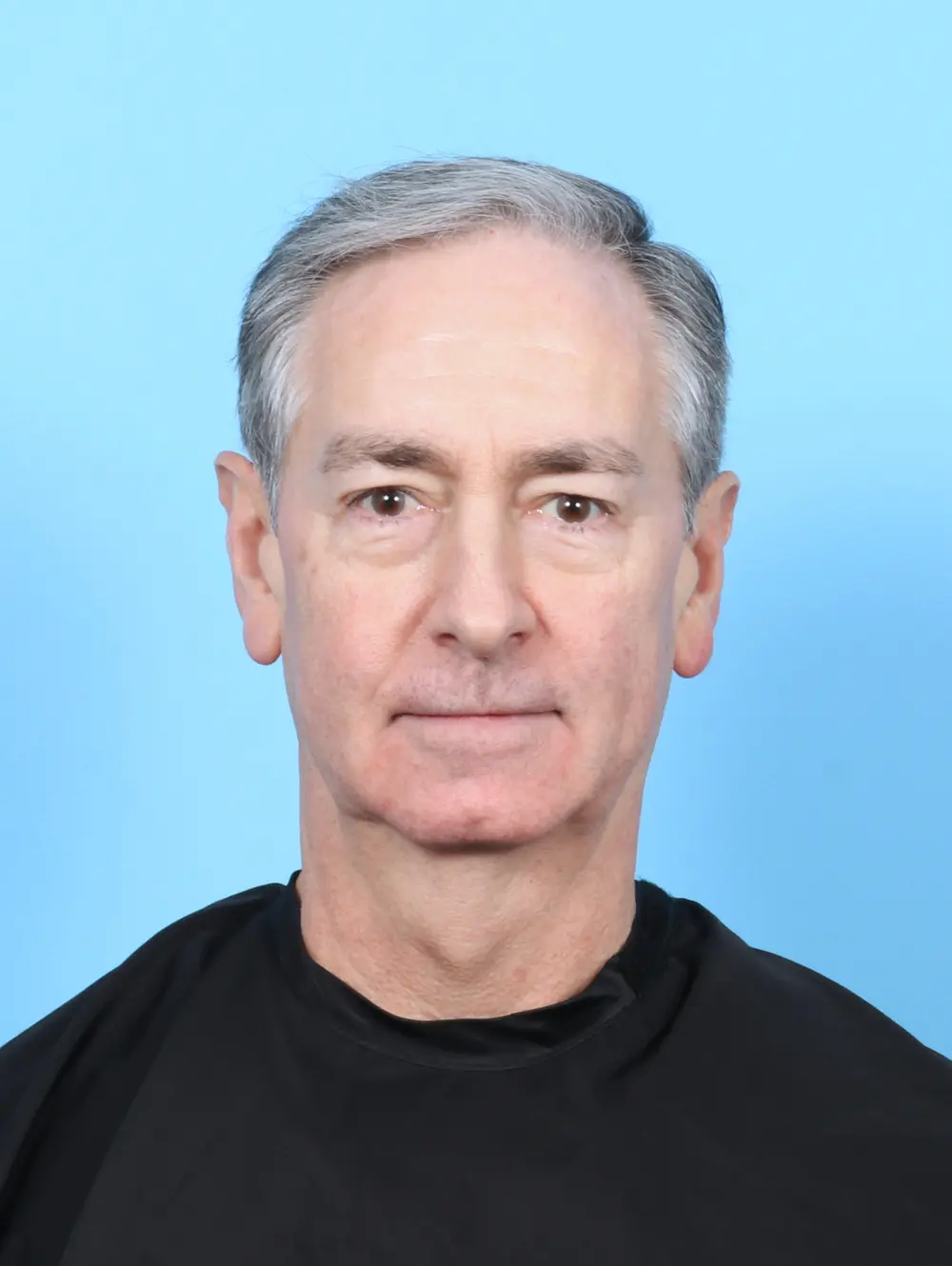 Chin Implant Patient Photo - Case 55097 - before view-2