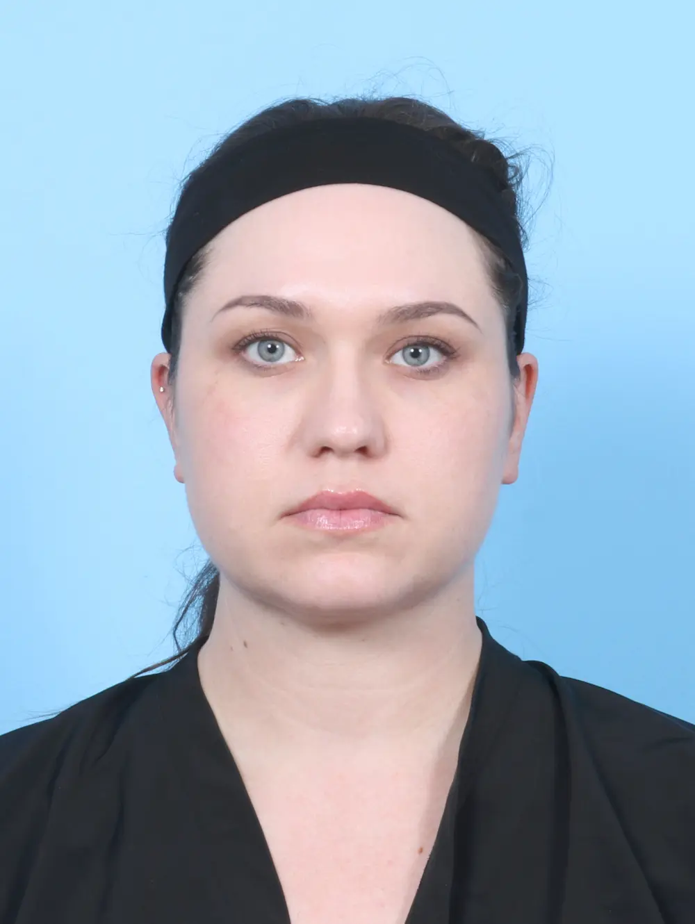 Liposuction Patient Photo - Case 55201 - after view-2