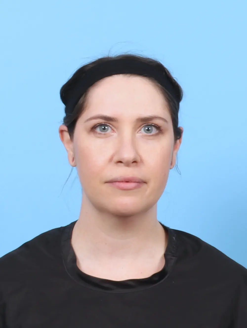 Anterior Neck Lift Patient Photo - Case 55877 - before view-3