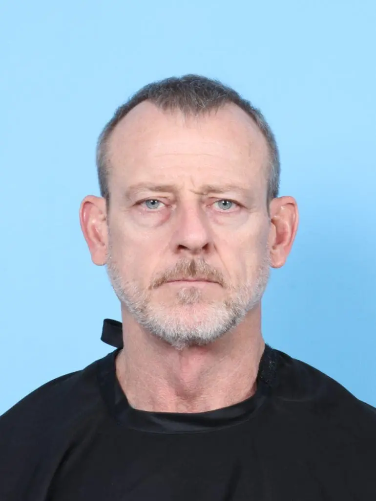 Eyelid Surgery - Case 56492 - Before