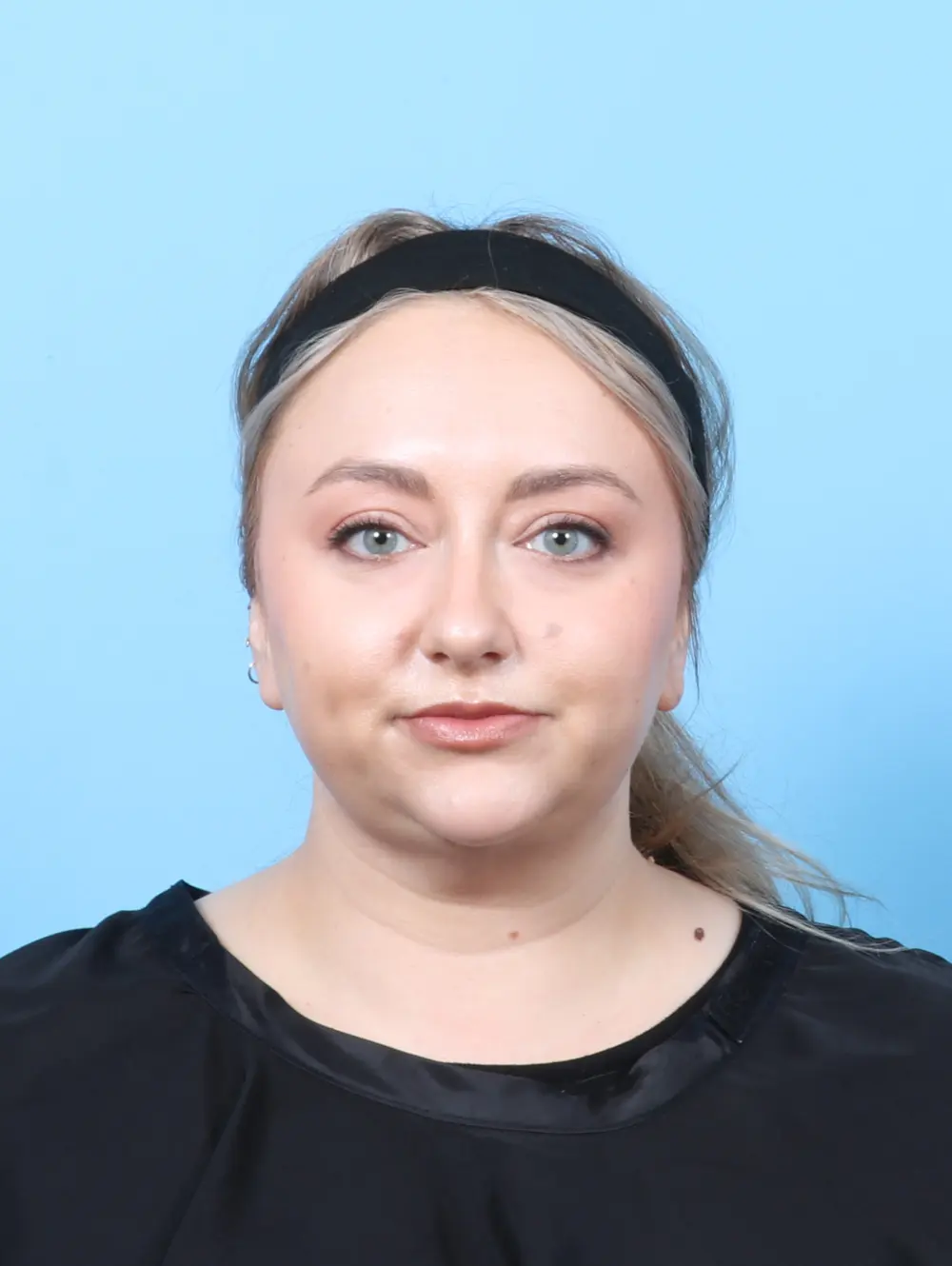 Liposuction Patient Photo - Case 56589 - after view-2