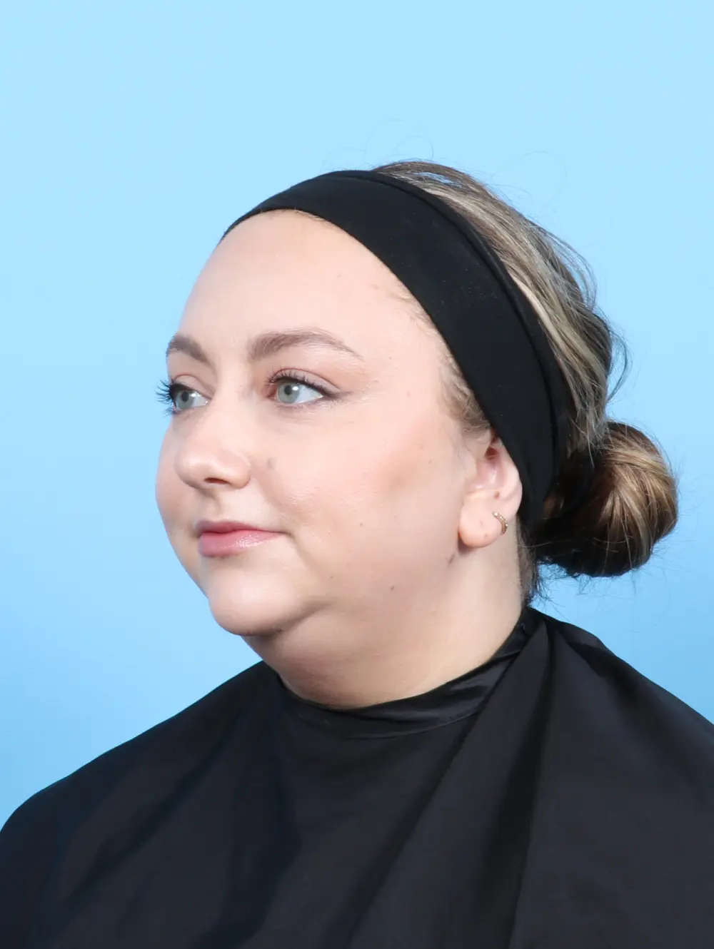 Liposuction Patient Photo - Case 56589 - before view-1