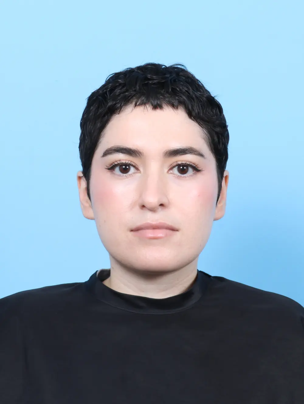 Rhinoplasty Patient Photo - Case 56597 - before view-2