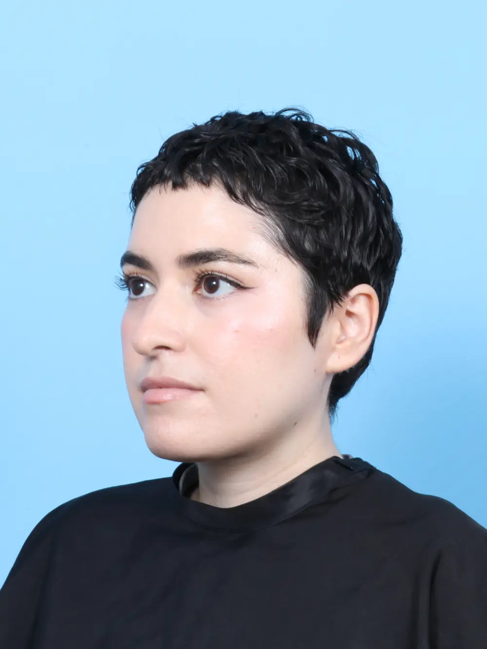 Rhinoplasty Patient Photo - Case 56597 - before view-1