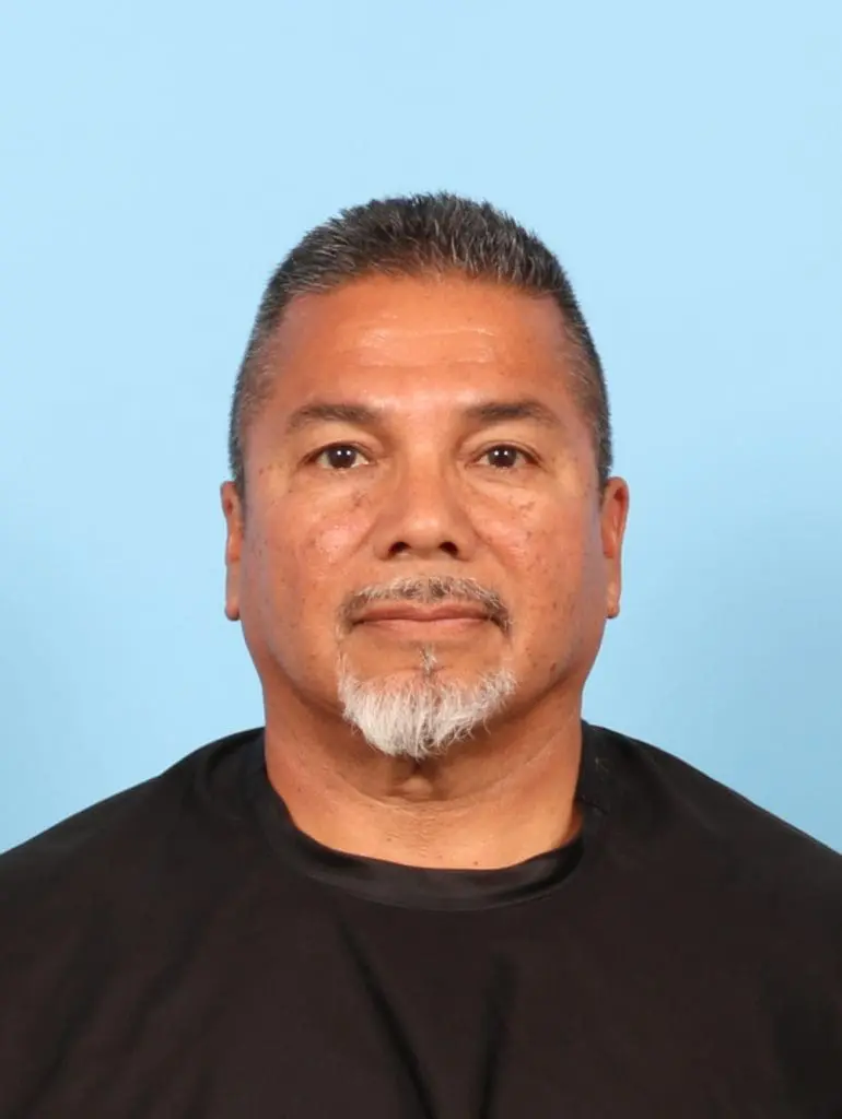 Eyelid Surgery - Case 56605 - Before