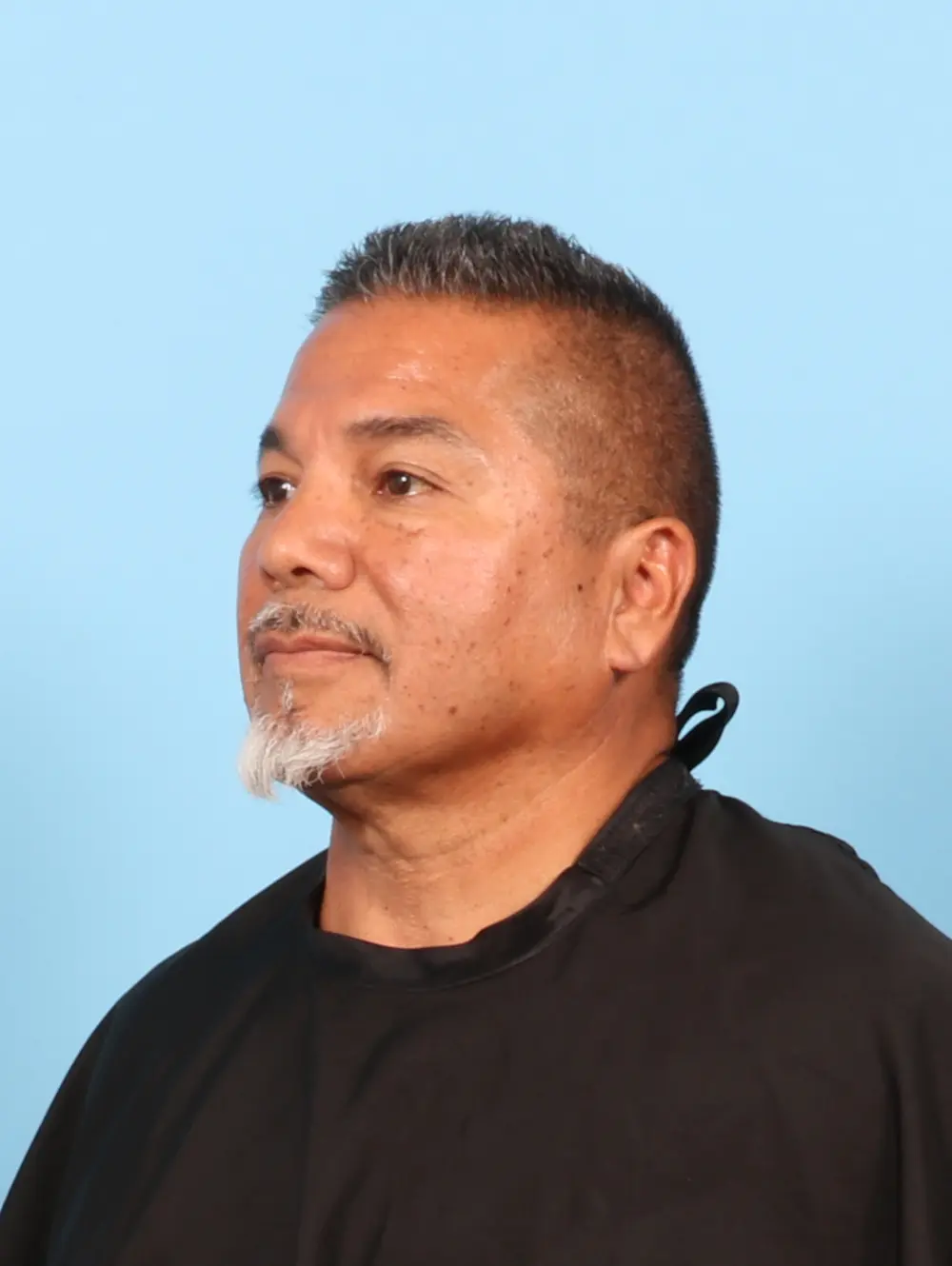 Eyelid Surgery Patient Photo - Case 56605 - before view-1