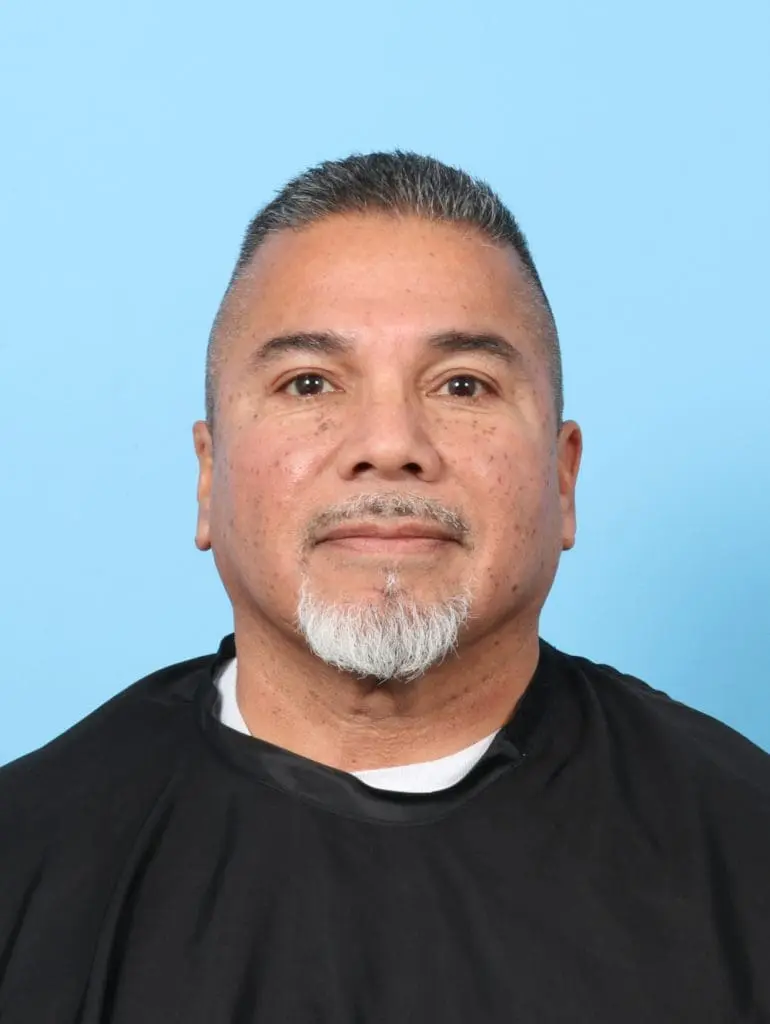 Eyelid Surgery - Case 56605 - After