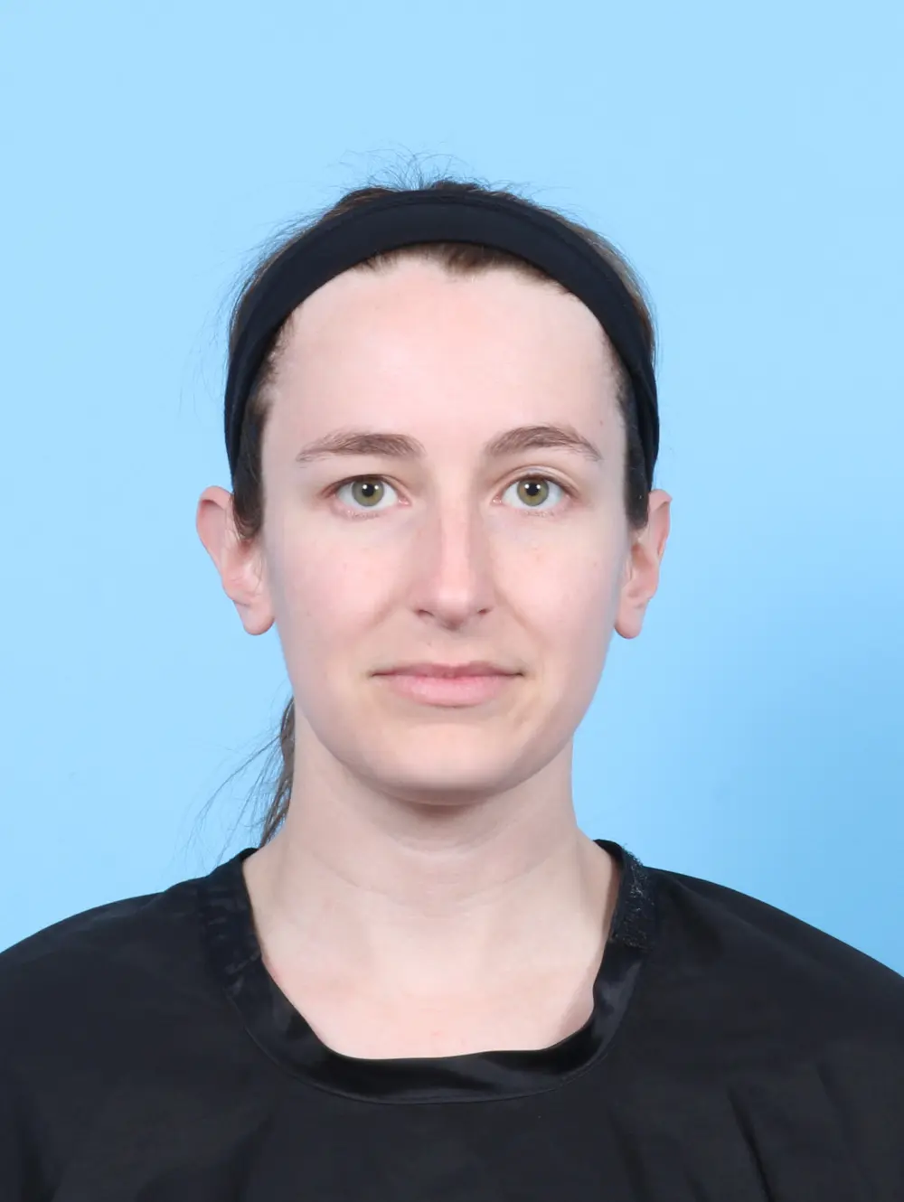 Rhinoplasty Patient Photo - Case 56692 - before view-2