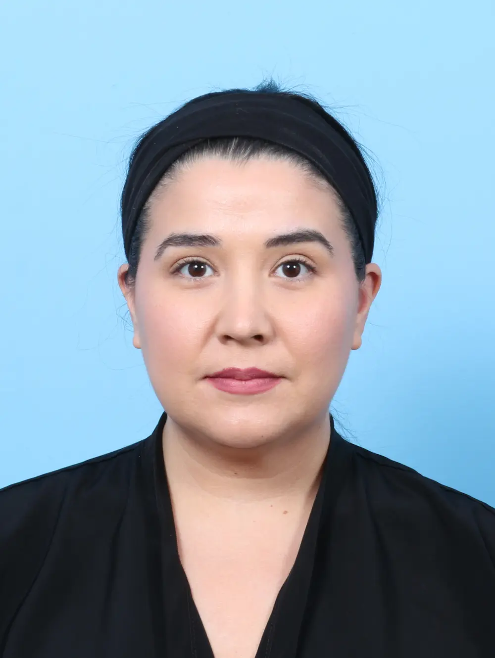 Liposuction Patient Photo - Case 57713 - after view-2