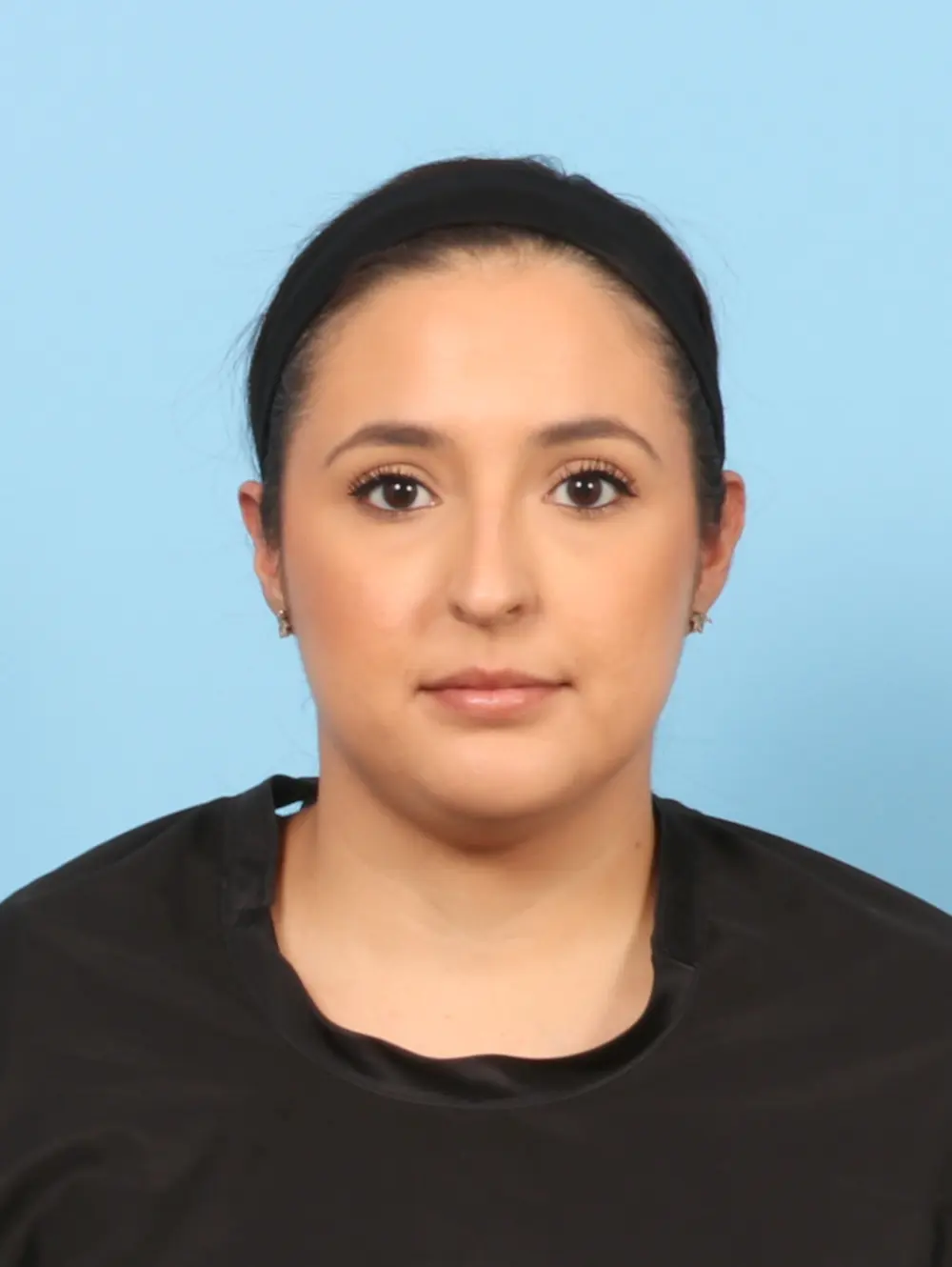 Rhinoplasty Patient Photo - Case 57913 - before view-2